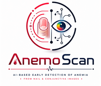 AnemoScan: Ai – Based Early Detection of Anemia from Nail & Conjunctiva Images